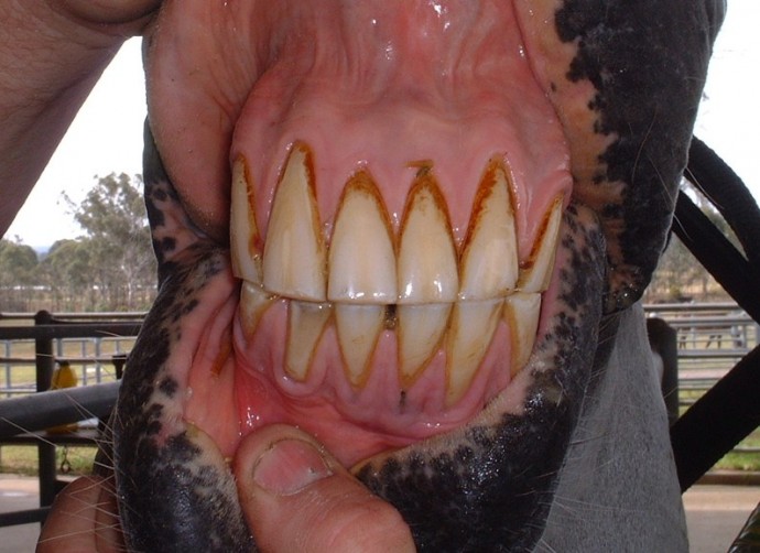 Periodontal Disease - An Overview